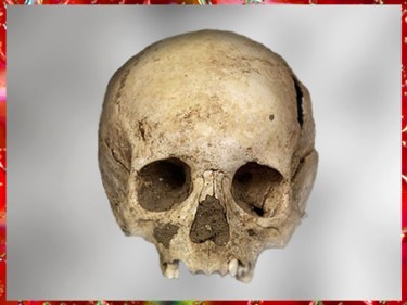 D'après un crâne humain de l'âge de Bronze. (Marsailly/Blogostelle)